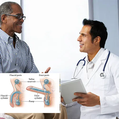 Why Choose Robert Cornell, MD, PA


 for Your Penile Implant Surgery?